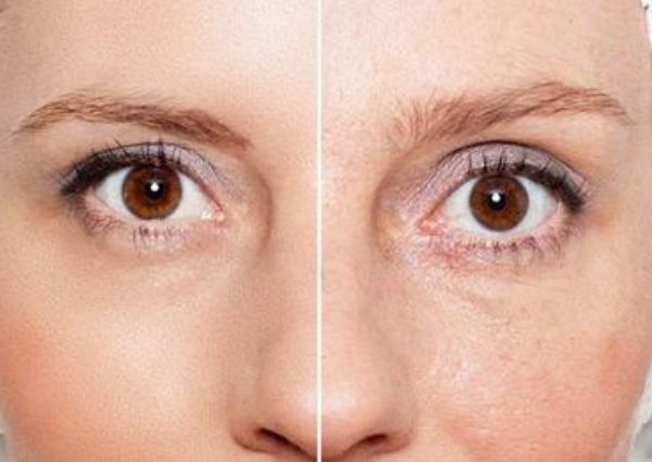 before and after of a womans skin