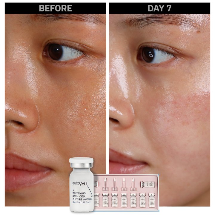Before and after comparison of a woman's skin area after treatment with Whitening Stem Cell Culture Ampoule