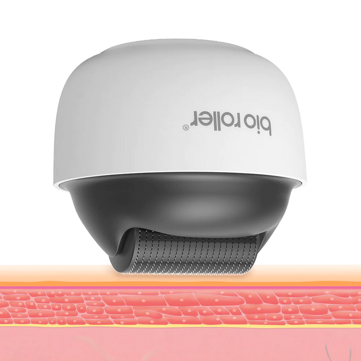Bio Roller G4 Microneedling para Crescimento da Pele e do Cabelo (1200 Pins)
