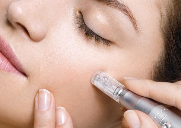 Who can get microneedling?