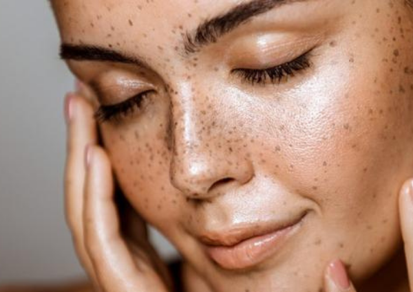 woman with freckles and shiny skin looking down