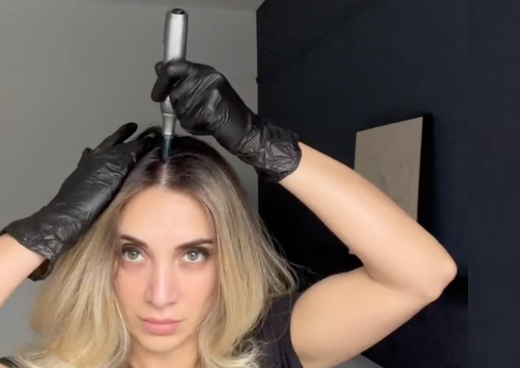 All About Microneedling on Your Scalp: A Guide On How To Boost Hair Growth