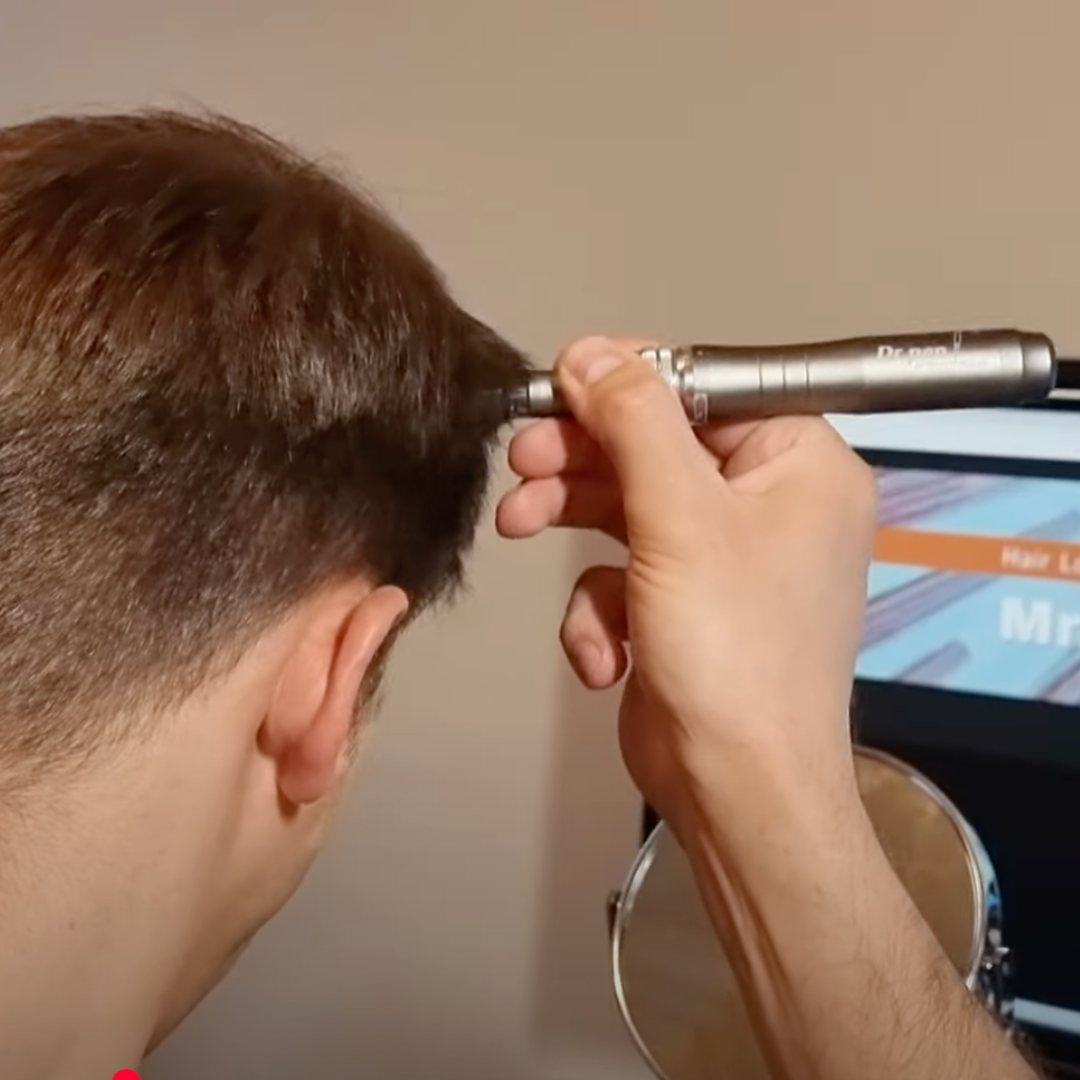 Dr. Pen M8S Microneedling Pen