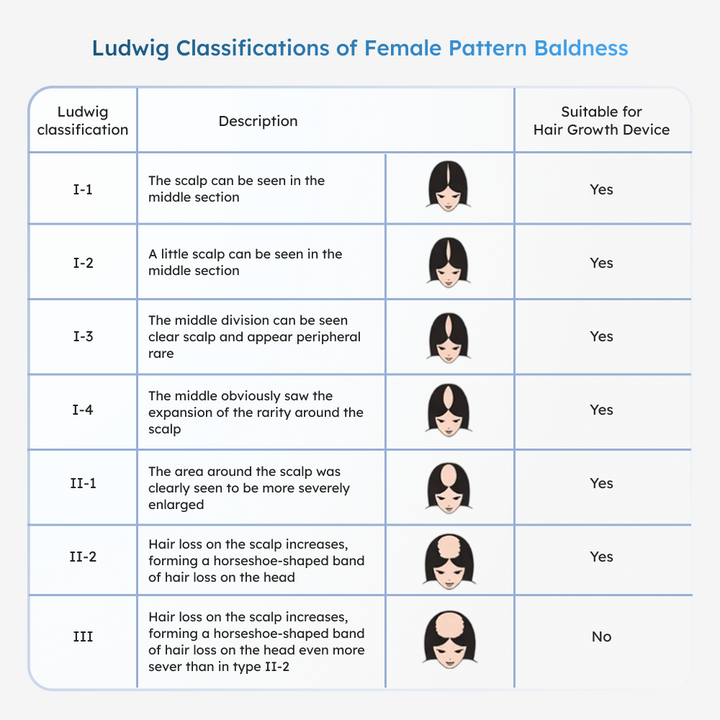 Table of Ludwig classifications for female pattern baldness with corresponding images and suitability for Reboot Volume Max Hair Growth Helmet 
