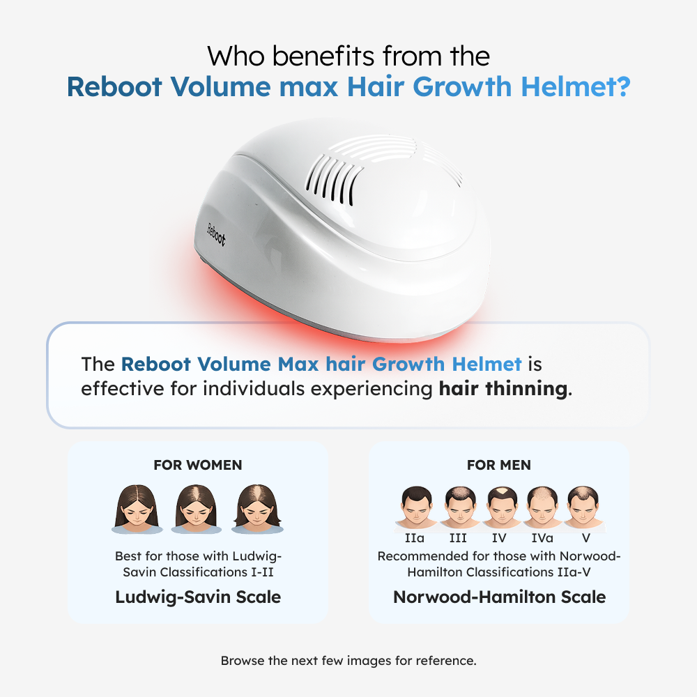 Table of Ludwig classifications for female pattern baldness with corresponding images and suitability for Reboot Volume Max Hair Growth Helmet 