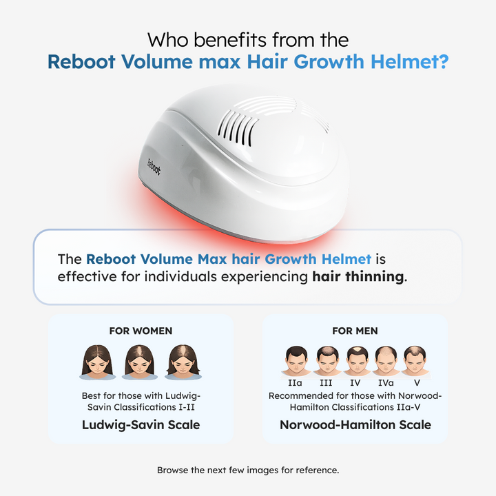Table of Ludwig classifications for female pattern baldness with corresponding images and suitability for Reboot Volume Max Hair Growth Helmet 