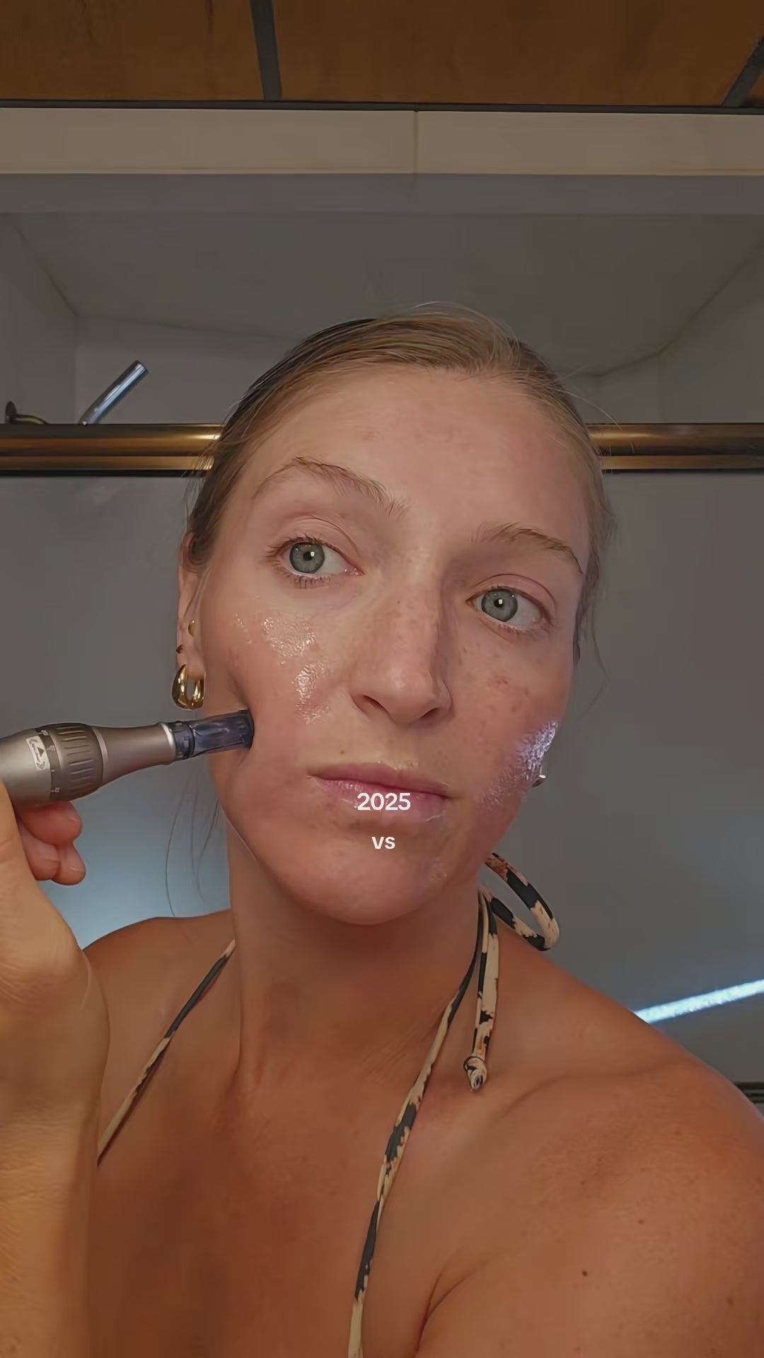 Dr. Pen A20 Advanced Microneedling Pen for Professionals