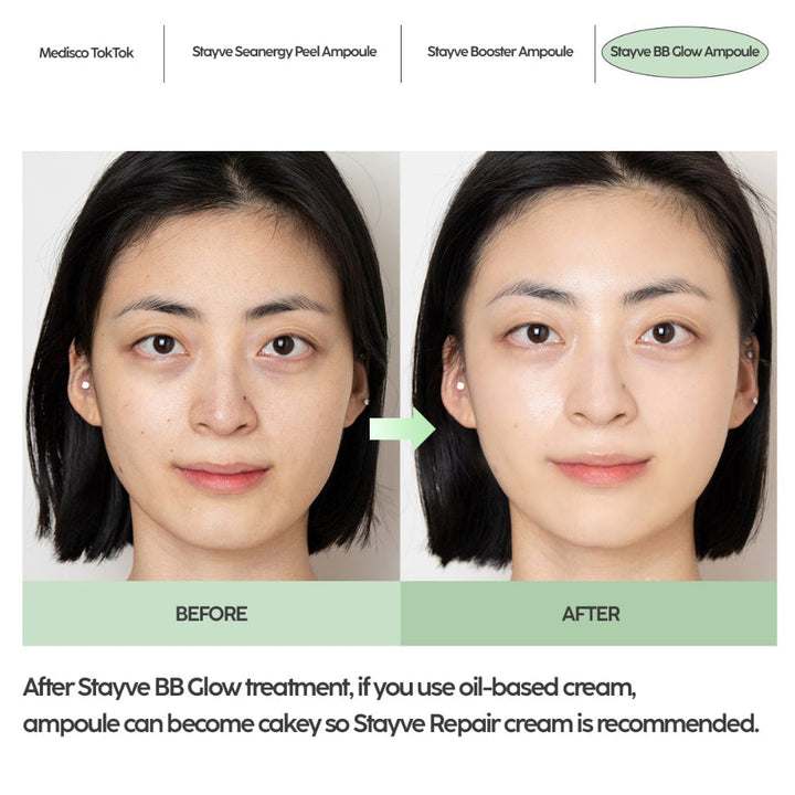 Stayve BB Glow aftercare guide recommending Stayve repair cream after treatment 